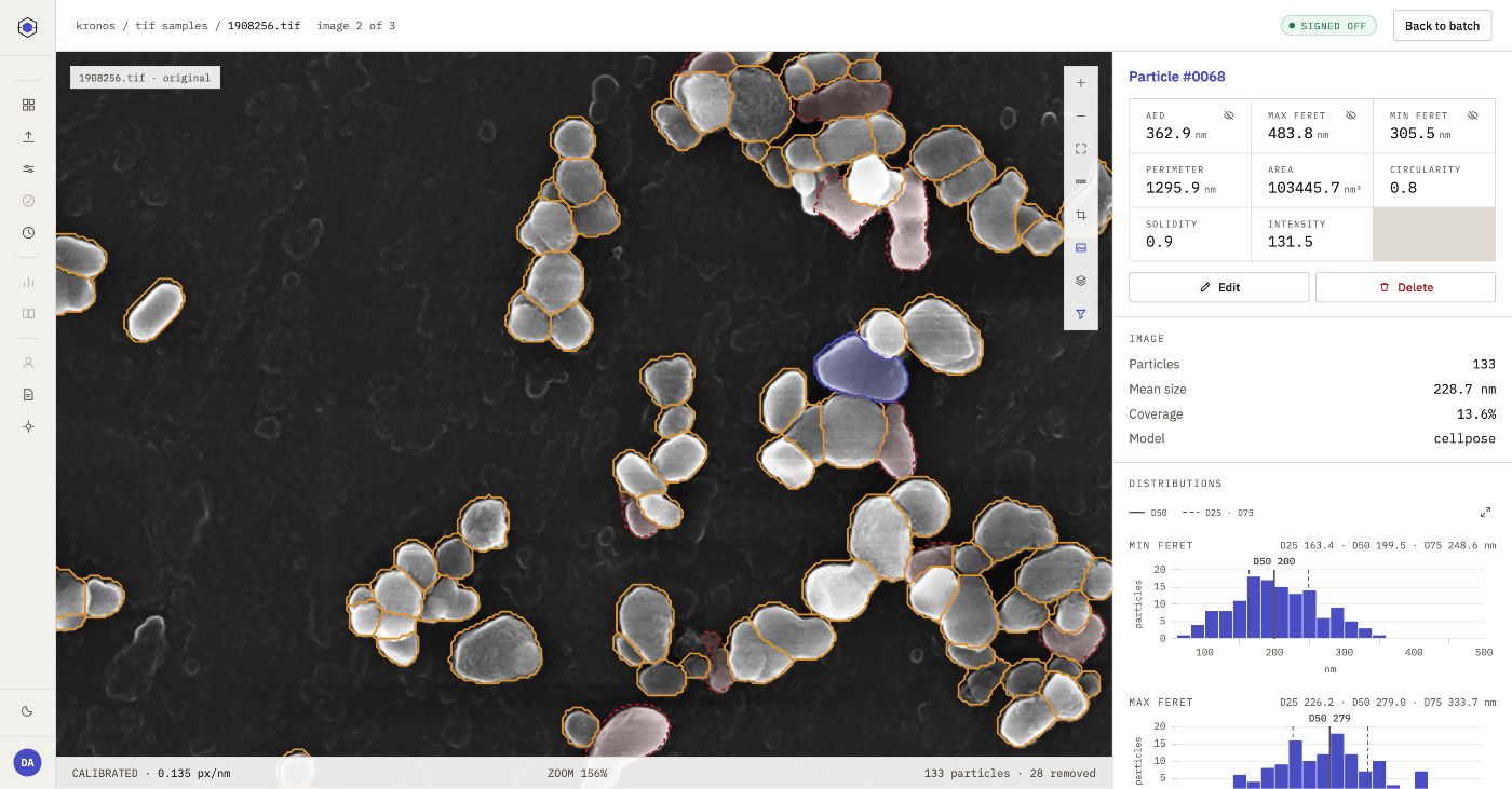 The Atlas workbench: a micrograph with detected particles outlined, beside per-particle measurements and filter controls.